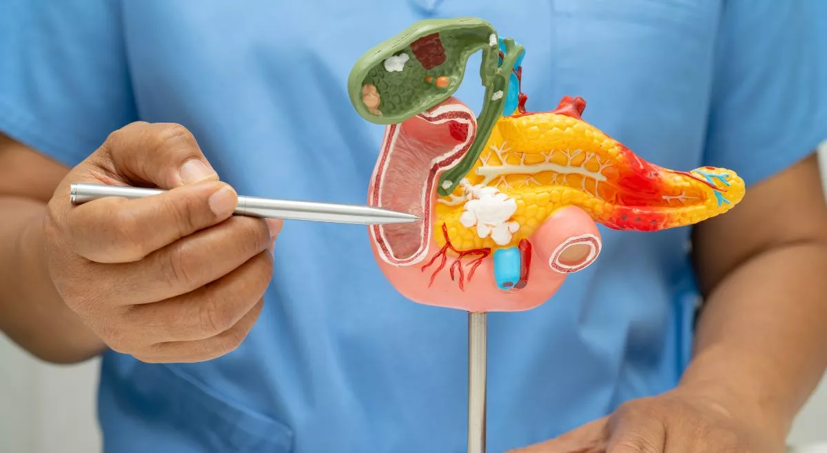 Pancreatic Cancer Cure: Latest Research, Treatments & Success Stories